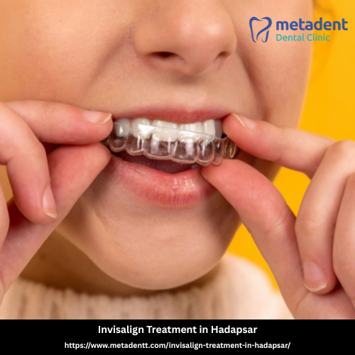 Invisalign Treatment in Hadapsar