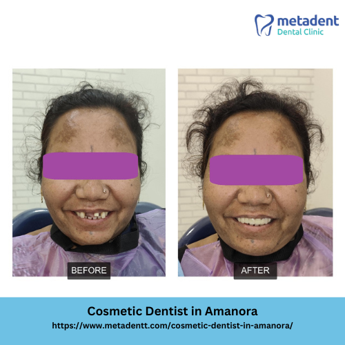 Cosmetic Dentist in Amanora